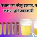 पीला पेशाब का घरेलू इलाज, कारण, लक्षण पूरी जानकारी