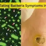 Flesh Eating Bacteria Symptoms in Hindi