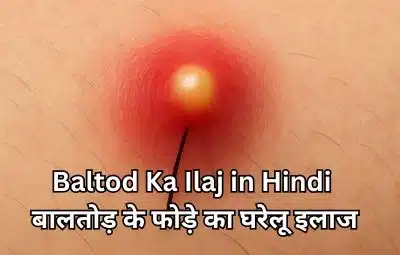 Baltod Ka Ilaj in Hindi